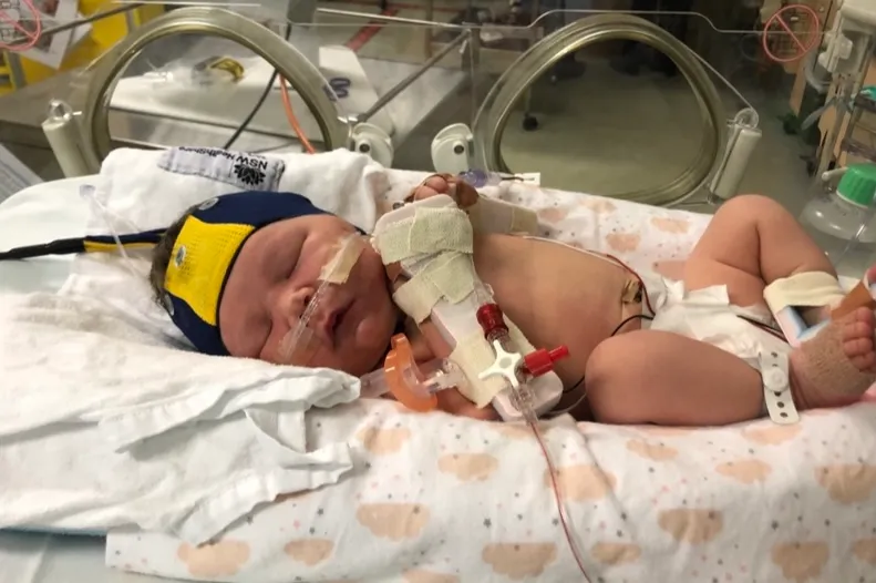 A newborn baby in intensive care with an EEG cap on her head and lines in her arm.